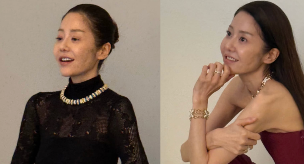 Go Hyun Jung’s slimmer appearance in new jewelry photos raises concern as actress explains her past emergency surgeries and ongoing treatment